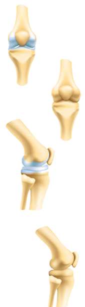 Orthopedic doctors in guntur