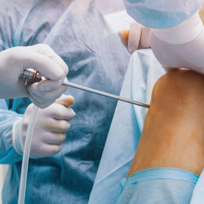 arthroscopy sports medicine in guntur