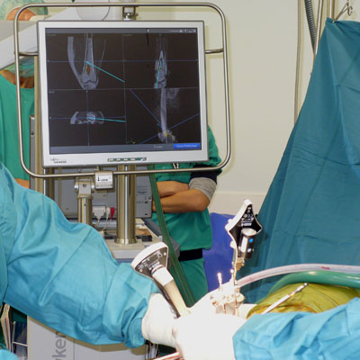 Computer Assisted Spine Surgery