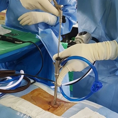 endoscopic spine surgery in guntur